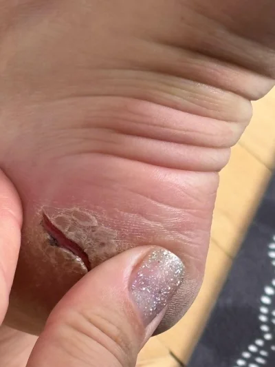 jmuhha - Co na taką  pięte (od suchego powietrza w biurze)