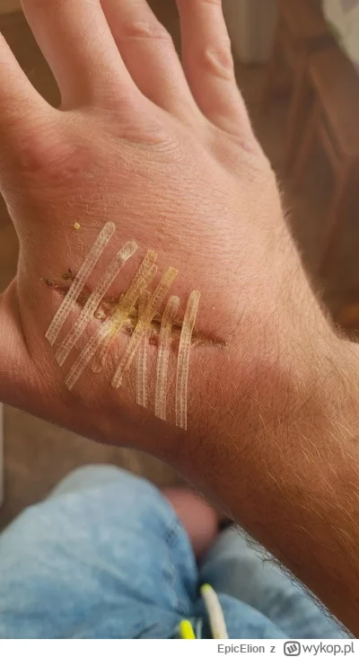 EpicElion - Dobrze to zrobiłem?