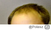 Polasz - @frow dziękuję dziękuję ( ͡° ͜ʖ ͡°)
@jednorazowka: a na imię Paweł. Tak jak ...