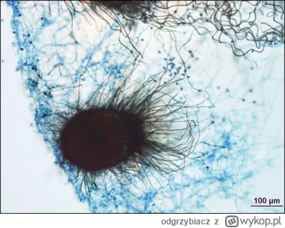 odgrzybiacz - Grzyb pleśniowy pod mikroskopem