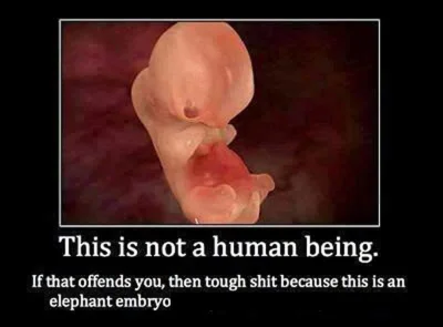 L.....e - Zapamiętajcie, to na obrazku to nie człowiek.
#takaprawda #aborcja #bekazk...