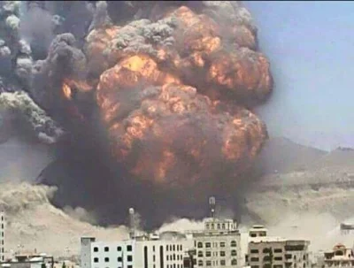 PatologiiZew - Kolejny dzień bombardowania stolicy Jemenu. Kolejni cywile którzy umie...