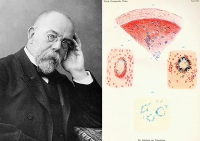 cieliczka - Tego dnia, 24 marca 1882 roku, Robert Koch - niemiecki lekarz, blisko zwi...