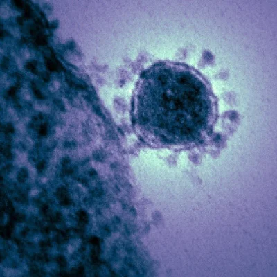 SkrytyZolw - Koronawirus SARS CoV 2 (2019-nCoV) widoczny pod mikroskopem elektronowym...