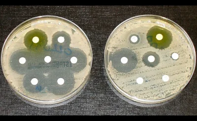 MalyBiolog - Czym jest antybiotykooporność i jak chronić antybiotyki? >>> ZNALEZISKO ...