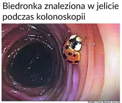 r.....y - Jak do tego doszło nie wiem


#humorobrazkowy #wtfcontent #medycyna