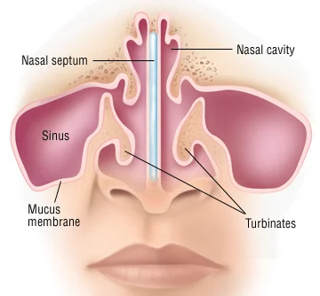 Noniusz - @SeriouslyDude @piter12: Każdy ma w nosie septum (po polsku "przegroda noso...