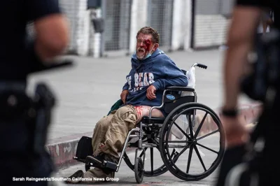 xxRazorxx - Bezdomny na wózku, nie mający nic wspólnego z protestami został postrzelo...