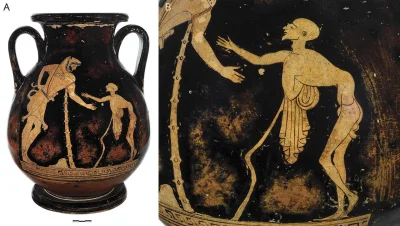 myrmekochoria - Amfora prezentująca osobę chorą na polio, Grecja 480 rok przed naszą ...