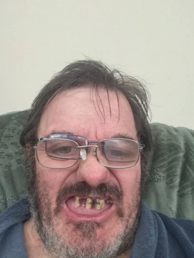 DADIKUL - @SkrytyZolw wielka Brytania-odsetek 50 latków bez zębów wynosi 95%.
Lekarze...