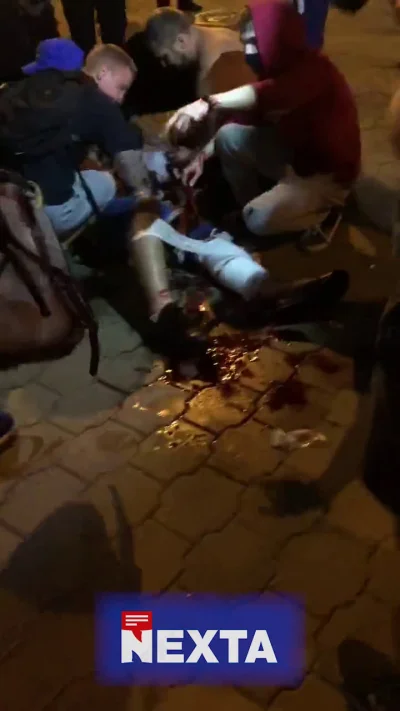 spaduwamamrobote - Kolejny poważnie ranny na Puszkinskiej.
#bialorus