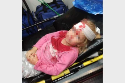 szurszur - 5 letnia dziewczynka z Grodna została ranna gdy OMON-owcy pałkami wybili s...