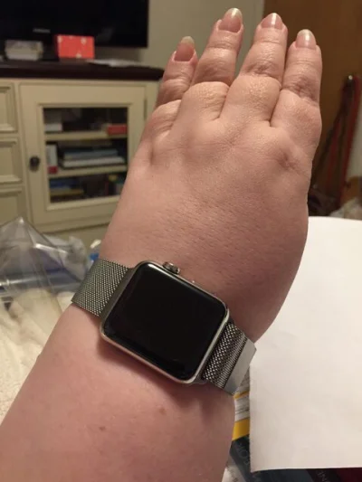 Metzger3 - @kelums: Tylko Apple Watch.