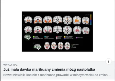 bioslawek - @Kargaroth: https://www.wykop.pl/link/4748847/juz-mala-dawka-marihuany-zm...