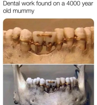 zwirz - Już 4000 lat temu robili zęby na NFZ.
#heheszki #dentystasadysta