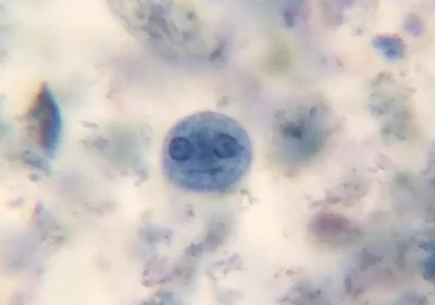 RandomowyJanusz - Ameba pod mikroskopem,a w środku nanowykopek ( ͡° ͜ʖ ͡°)
#wykopfac...