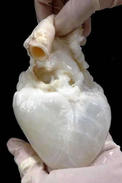 JoeShmoe - Serce ludzkie nie zawierające krwi. #ciekawostki #nauka #biologia