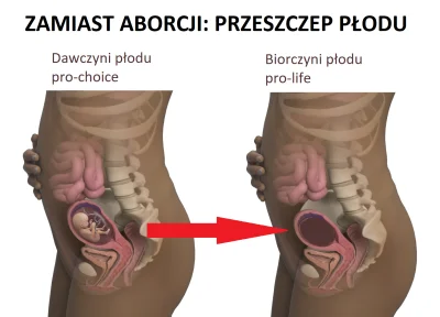 R187 - Uwaga, wymyśliłem jak rozwiązać problem aborcji: wystarczy zmienić nazwę tego ...