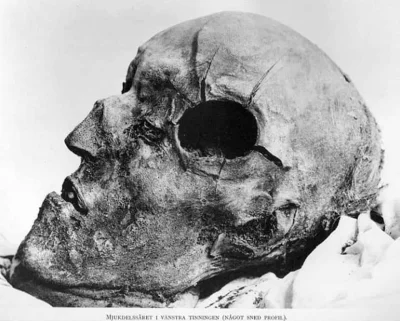 piotr-zbies - Głowa Karola XII po spotkaniu z kulą ołowianą kal. 20mm. Po tej stronie...