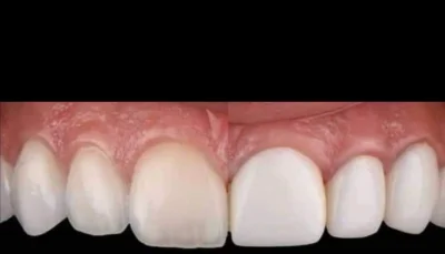 konda - Które zęby wam się bardziej podobają. Lewa czy prawa?
#ankieta #stomatologia ...