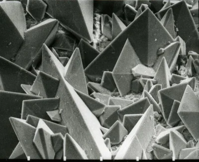 xxii - Kamień nerkowy pod mikroskopem