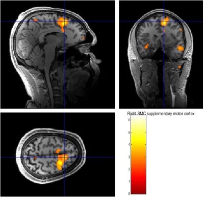 rainkiller - Wczoraj robiąc pilot procedury fMRI zeskanowałem swój mózg wykonując zad...