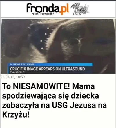 saakaszi - Tak było ( ͡º ͜ʖ͡º)

https://www.fronda.pl/a/to-niesamowite-mama-spodzie...