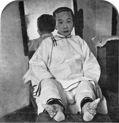 myrmekochoria - Chińska kobieta pokazuje swoje stopy, które wiązano jej od dzieciństw...