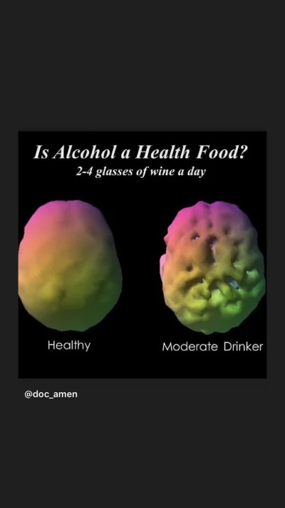 phoropter - Zdjęcia przedstawiają mozg osoby nie pijącej alkoholu a po prawej, mozg c...