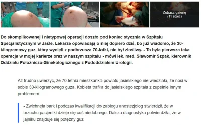chosenon3 - #ciekawostki #jaslo #medycyna