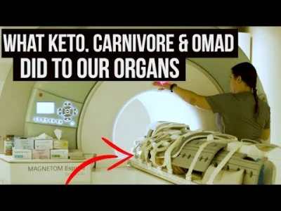 I.....o - Analiza ciał ludzi na #keto i #carnivore jedzących jeden posiłek dziennie #...