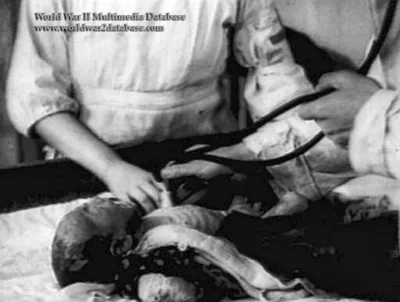 myrmekochoria - Niemowlak z oparzeniami leczony przez lekarzy po atomowym ataku na Hi...