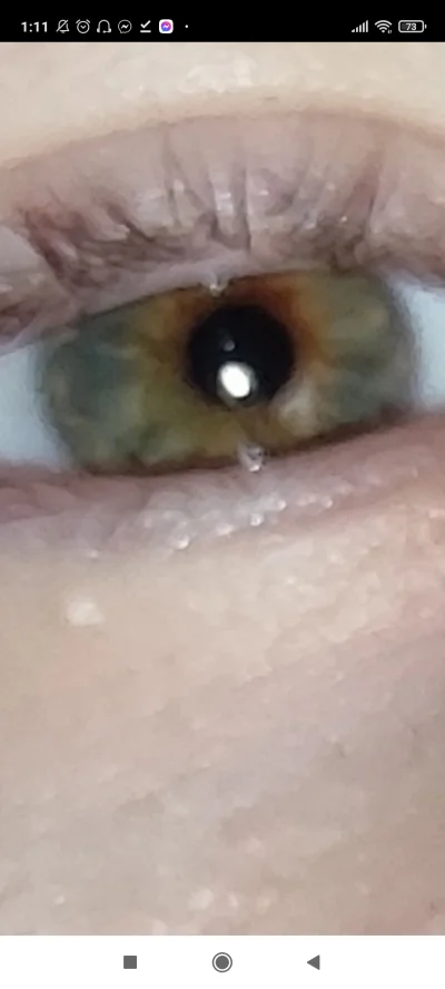 g.....m - Jaki to jest kolor oczu? #kiciochpyta
