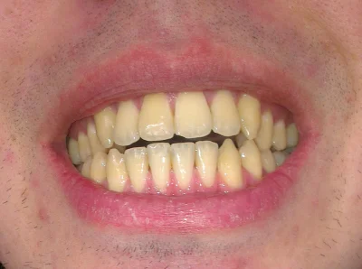 beztabu - #stomatologia #dentysta 

Przeglądam sobie Reddit i znalazłem wątek z tak...