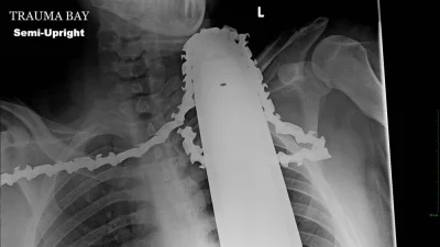 Kosciany - #xray


A chainsaw to the neck is no routine injury – but fortunately f...