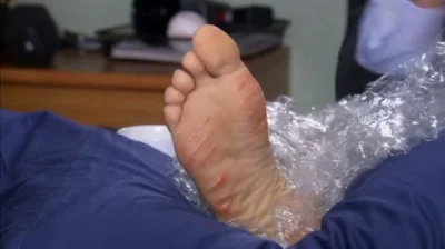 Brant - @nicspecjalnego: to może feet fetish?