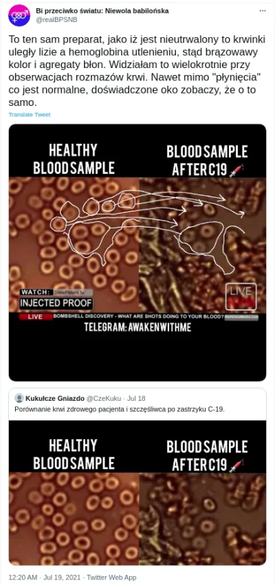 fiziaa - Tak się tworzy antyszczepionkowe newsy: 
https://twitter.com/realBPSNB/stat...