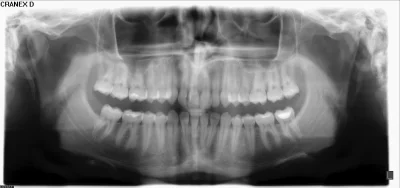 AnonimoweMirkoWyznania - #anonimowemirkowyznania 
Ostatnio byłem u ortodonty pierwszy...