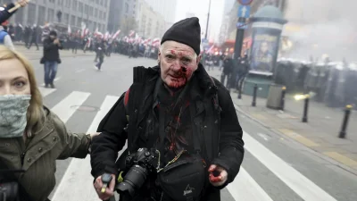 Kuklak - > Siłowym co... ? Pokaż mi policję z pistoletami na gumowe kulki i rany od p...