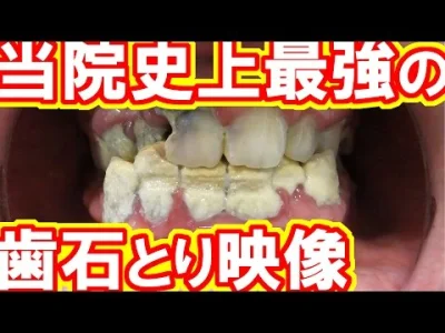 Szaa - #zeby #dentysta #kamieniarstwo #zeby Niesamowicie satysfakcjonujące