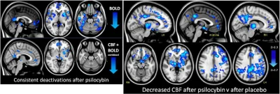 wellbeing - Twój mózg idzie spać po wzięciu psylocybiny

https://www.researchgate.n...