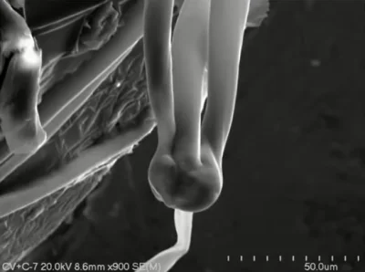 Miszkurka2000 - Alien life form in Pfizer-BioNTech COVID-19 Vaccine - Photo by Dr Fra...