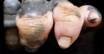 PorzeczkowySok - Zdjęcie dłoni goryla z zanikiem pigmentacji, która wygląda jak ludzk...
