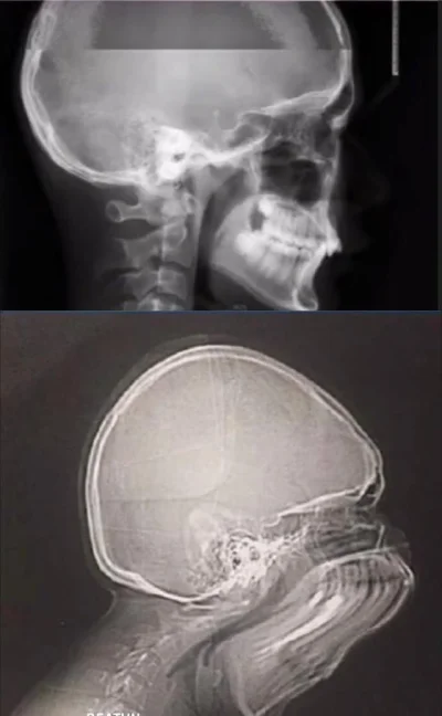 Kosciany - #xray
Kichnięcie