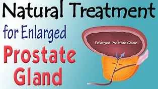 JoelSavage - @JoelSavage: When does prostate enlargement begin and how can it be cure...