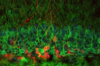 Badmadafakaa - Komórki nerwowe regenerują się: pierwszy obraz neuronów rosnących w ży...