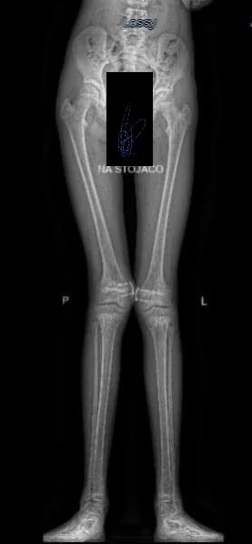 Poemat - #mikrophysio 

1) Koszykarz zawodowy, lat 23. Około 6 tygodni temu doznał ur...