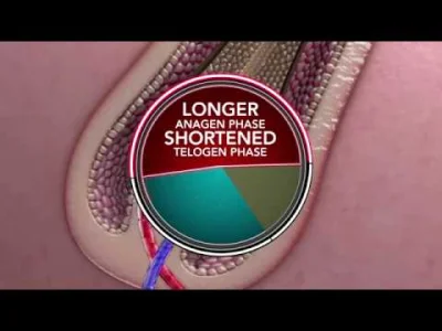 feegloo - Fajna animacja pokazująca jak działa minoxidil na łysienie androgenowe

#...