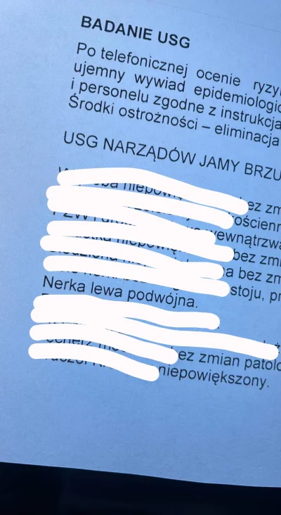 Ka4az - Ktoś wie gdzie mogę ja sprzedać za duże siano? ( ͡° ͜ʖ ͡°) 

#organy #medycyn...