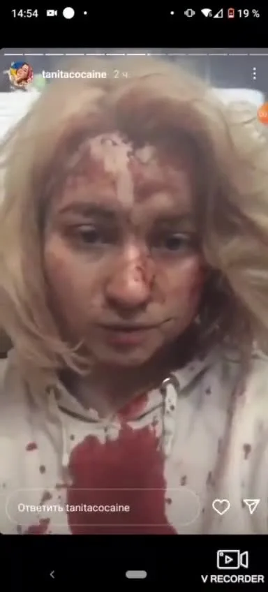obserwatorww3 - Ocalała dziewczynka po tym, jak rosyjski samolot zrzucił bombę na szk...